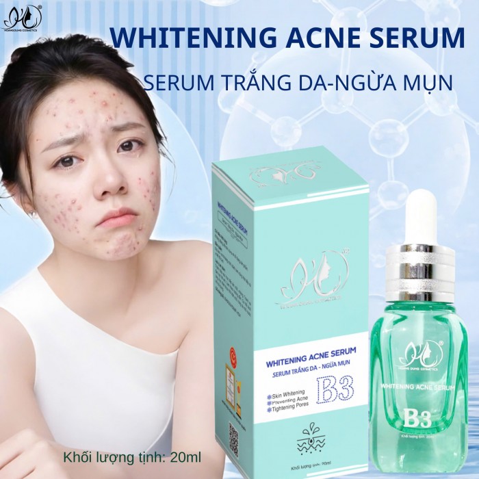 Serum mặt HD HOÀNG DŨNG ngừa mụn trắng da 20ml